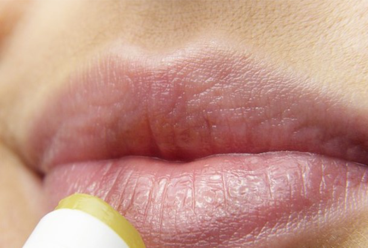 Best CBD Lip Balm: Want to Know How to Get Soft Lips