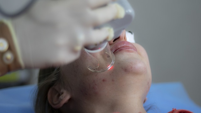 Doctor, Laser treatment, scar tissue