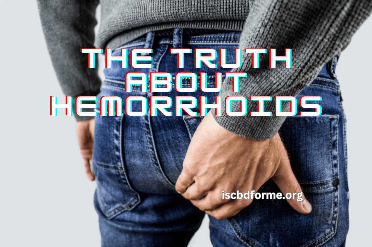 The Truth About Hemorrhoids and Remedies